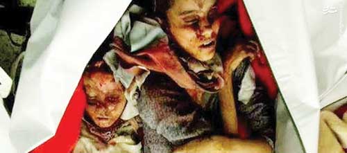 خون ۷ هزار۵۰۰ کودک یمنی بر دشداشه سعودی