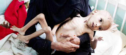 مرگ در کمین میلیون‌ها کودک یمنی
