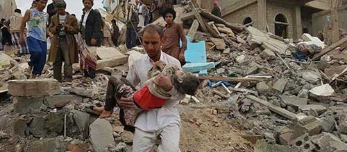 فاجعه انسانی تنها میزبان یمنی‌ ها